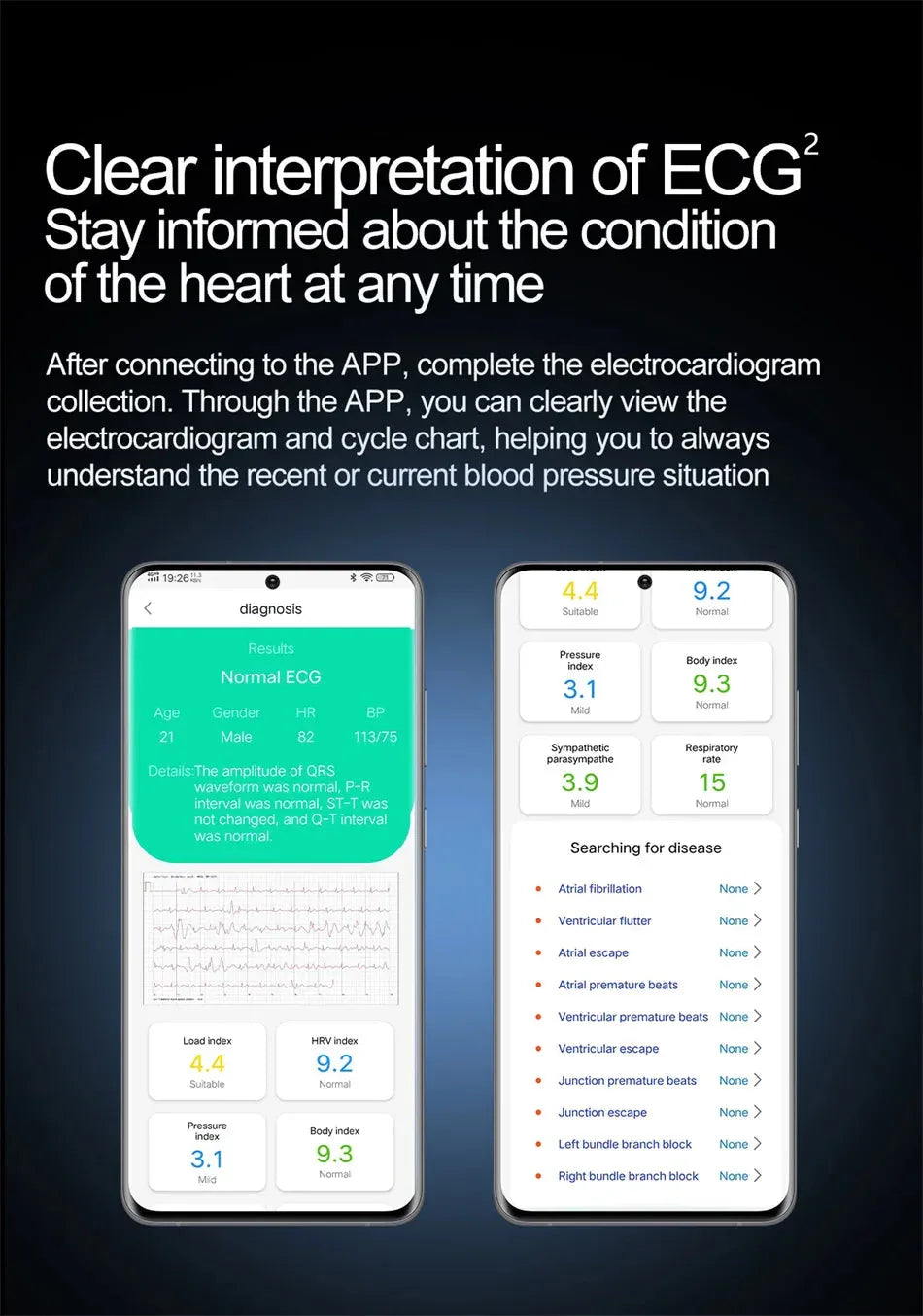 KAVSUMI S25 Smartwatch™ - RS Store